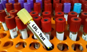 Vì sao ăn thuần chay vẫn tăng cholesterol? Vì sao ăn thuần chay vẫn tăng cholesterol?