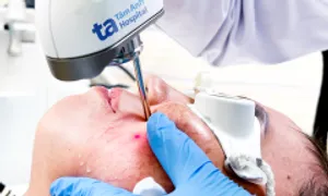 Nổi mụn, giãn mạch máu mặt do dùng kem trắng da cấp tốc Nổi mụn, giãn mạch máu mặt do dùng kem trắng da cấp tốc