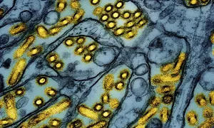 Nguyên nhân khiến virus cúm biến chủng nhanh Nguyên nhân khiến virus cúm biến chủng nhanh