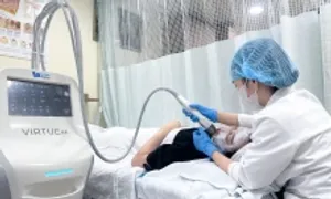 Có nên trị sẹo mụn bằng vi kim? Có nên trị sẹo mụn bằng vi kim?