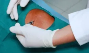 Tác dụng của tiêm khớp vai Tác dụng của tiêm khớp vai
